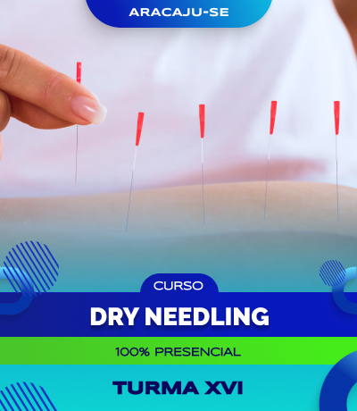 Curso de Dry Needling (Aracaju) - Turma XVI