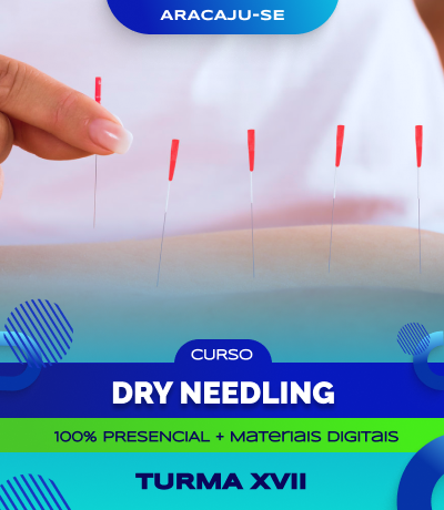 Curso de Dry Needling (Aracaju) - Turma XVII